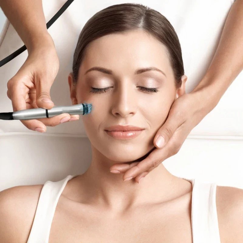 Microdermabrasion Treatment Oakville