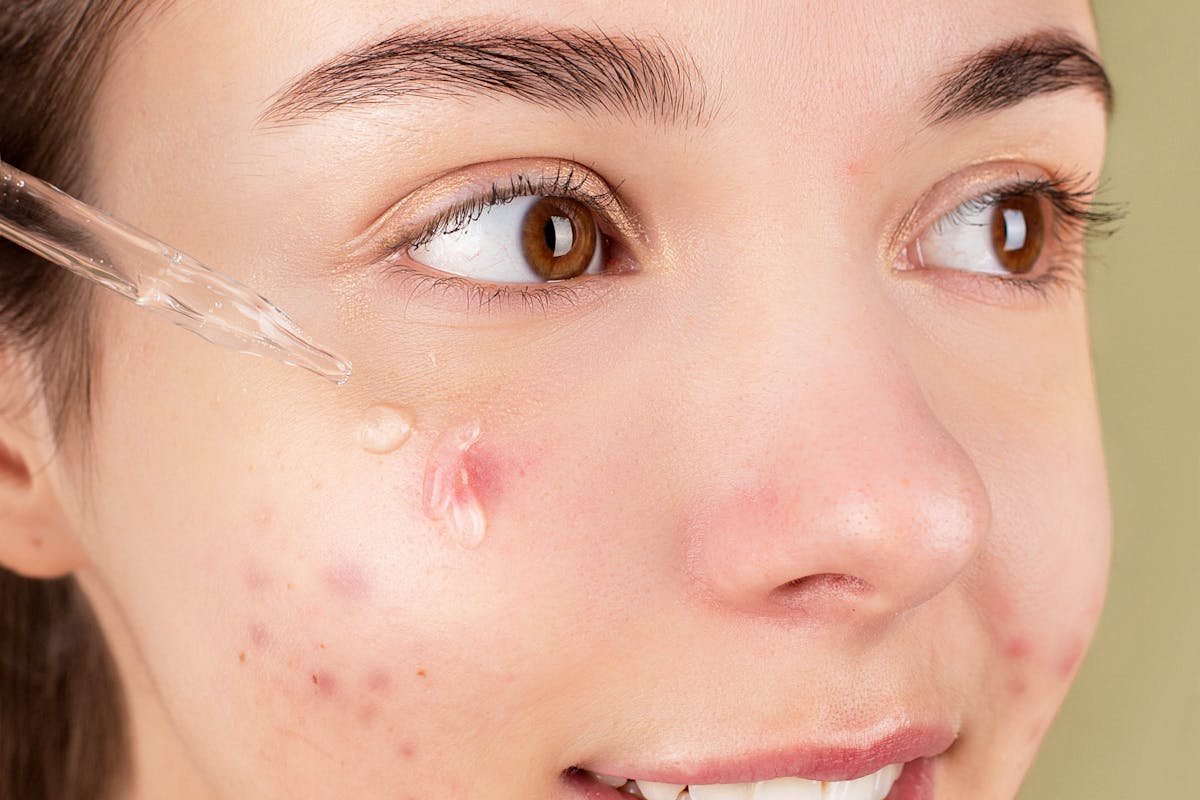 Anti-aging facial Treatment Oakville