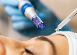 SkinPen Microneedling with Booster Oakville Clinic
