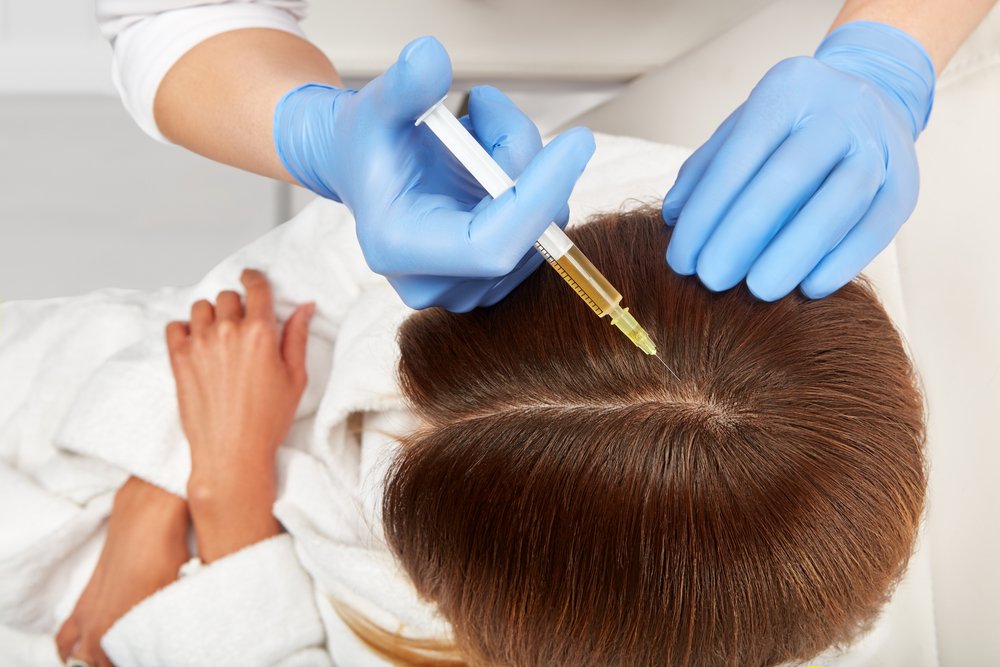 Platelet-Rich Plasma (PRP) for Hair Restoration Oakville Clinic