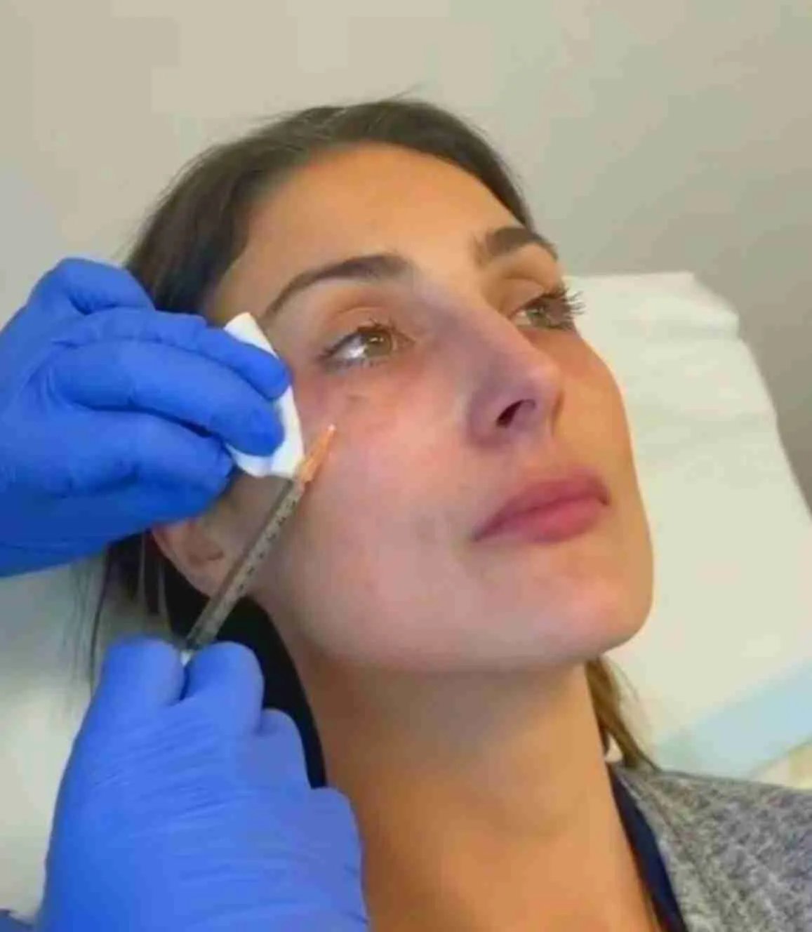 PRP for Dark Under-Eye Circles Oakville Clinic